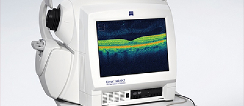 tomografia-de-coerencia-optica-oct